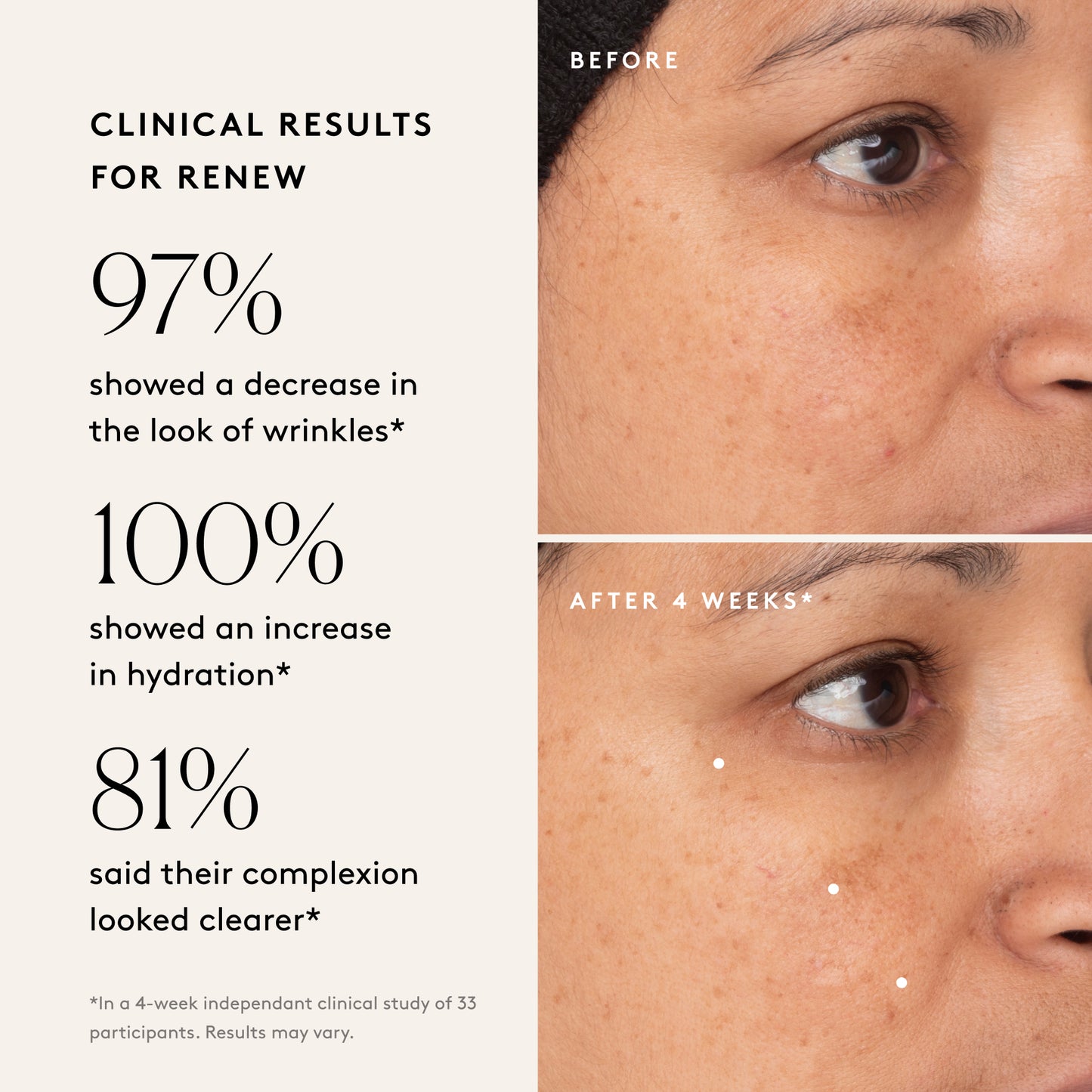 
                  
                    The Refresh Routine: Refresh, Renew, Rejuvenate New PDP
                  
                